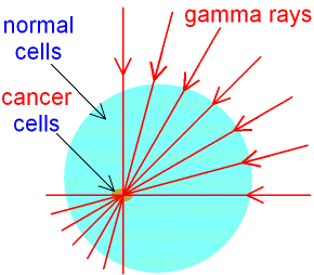 Using Gamma Rays for Radiotherapy